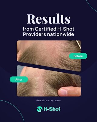 H-Shot social media post