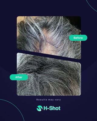 H-Shot before and after